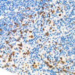 NGAL Antibody in Immunohistochemistry (Paraffin) (IHC (P))