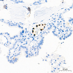 NGAL Antibody in Immunohistochemistry (Paraffin) (IHC (P))
