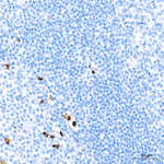 NGAL Antibody in Immunohistochemistry (Paraffin) (IHC (P))