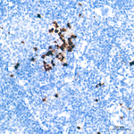 NGAL Antibody in Immunohistochemistry (Paraffin) (IHC (P))