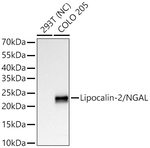 NGAL Antibody in Western Blot (WB)