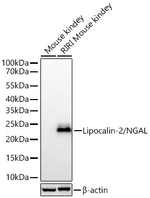 NGAL Antibody in Western Blot (WB)