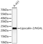 NGAL Antibody in Western Blot (WB)