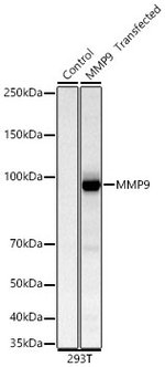 MMP9 Recombinant Rabbit Monoclonal Antibody (3C5V8)