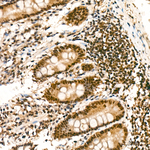 NFYA Antibody in Immunohistochemistry (Paraffin) (IHC (P))