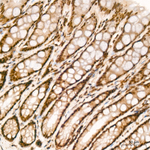 NFYA Antibody in Immunohistochemistry (Paraffin) (IHC (P))