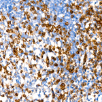 CD2 Recombinant Rabbit Monoclonal Antibody (1J3C2)
