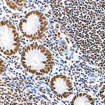 SETD2 Antibody in Immunohistochemistry (Paraffin) (IHC (P))