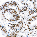 SETD2 Antibody in Immunohistochemistry (Paraffin) (IHC (P))