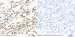 SETD2 Recombinant Rabbit Monoclonal Antibody (4P5K7)