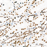 SETD2 Antibody in Immunohistochemistry (Paraffin) (IHC (P))