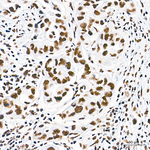 SETD2 Antibody in Immunohistochemistry (Paraffin) (IHC (P))