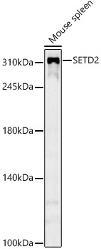 SETD2 Antibody in Western Blot (WB)