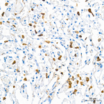 CD204 Antibody in Immunohistochemistry (Paraffin) (IHC (P))