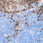 CD138 Antibody in Immunohistochemistry (Paraffin) (IHC (P))