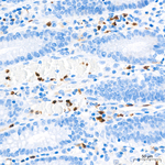S100A9 Antibody in Immunohistochemistry (Paraffin) (IHC (P))