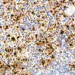 S100A9 Antibody in Immunohistochemistry (Paraffin) (IHC (P))