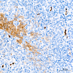 S100A9 Antibody in Immunohistochemistry (Paraffin) (IHC (P))