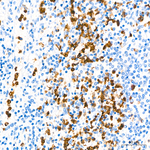 S100A9 Antibody in Immunohistochemistry (Paraffin) (IHC (P))