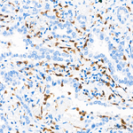 S100A9 Antibody in Immunohistochemistry (Paraffin) (IHC (P))