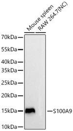 S100A9 Antibody in Western Blot (WB)