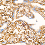 Neuropilin-1 Antibody in Immunohistochemistry (Paraffin) (IHC (P))