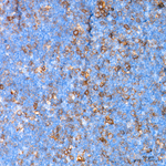 Neuropilin-1 Antibody in Immunohistochemistry (Paraffin) (IHC (P))