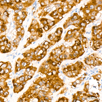 CYP51A1 Recombinant Rabbit Monoclonal Antibody (4Z9X10)