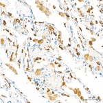 CYP51A1 Antibody in Immunohistochemistry (Paraffin) (IHC (P))