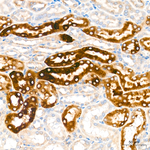 CYP51A1 Antibody in Immunohistochemistry (Paraffin) (IHC (P))