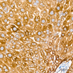CYP51A1 Antibody in Immunohistochemistry (Paraffin) (IHC (P))