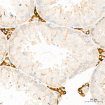 CYP51A1 Antibody in Immunohistochemistry (Paraffin) (IHC (P))