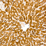 CYP51A1 Antibody in Immunohistochemistry (Paraffin) (IHC (P))