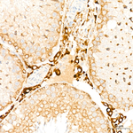 CYP51A1 Antibody in Immunohistochemistry (Paraffin) (IHC (P))