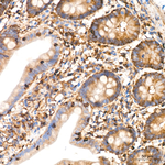 BIN1 Antibody in Immunohistochemistry (Paraffin) (IHC (P))