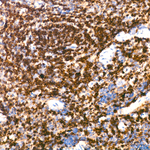 BIN1 Antibody in Immunohistochemistry (Paraffin) (IHC (P))
