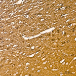 BIN1 Antibody in Immunohistochemistry (Paraffin) (IHC (P))