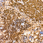 BIN1 Antibody in Immunohistochemistry (Paraffin) (IHC (P))