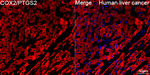 COX2 Recombinant Rabbit Monoclonal Antibody (4Z4J10)