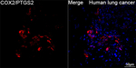COX2 Antibody in Immunohistochemistry (Paraffin) (IHC (P))