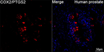 COX2 Antibody in Immunohistochemistry (Paraffin) (IHC (P))