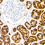 COX2 Antibody in Immunohistochemistry (Paraffin) (IHC (P))
