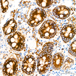 COX2 Antibody in Immunohistochemistry (Paraffin) (IHC (P))