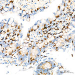 COX2 Antibody in Immunohistochemistry (Paraffin) (IHC (P))