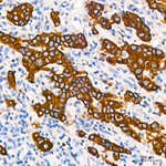 Cytokeratin 19 Antibody in Immunohistochemistry (Paraffin) (IHC (P))