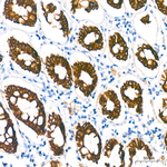 Cytokeratin 19 Antibody in Immunohistochemistry (Paraffin) (IHC (P))