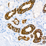 Cytokeratin 19 Antibody in Immunohistochemistry (Paraffin) (IHC (P))