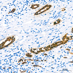 Cytokeratin 19 Antibody in Immunohistochemistry (Paraffin) (IHC (P))