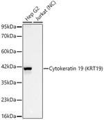 Cytokeratin 19 Antibody in Western Blot (WB)