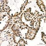 DDX1 Recombinant Rabbit Monoclonal Antibody (4I8A6)